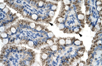 C20ORF100 Rabbit Polyclonal Antibody
