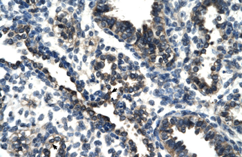 TSC22D4 Rabbit Polyclonal Antibody