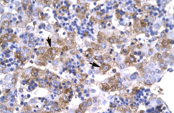 POU1F1 Rabbit Polyclonal Antibody