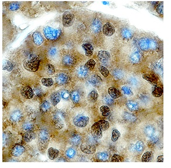 POU1F1 Rabbit Polyclonal Antibody
