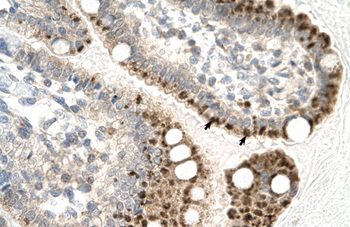 ZFP1 Rabbit Polyclonal Antibody