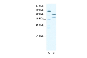 ZNF297B Rabbit Polyclonal Antibody