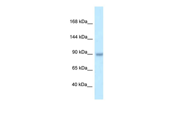 TBC1D2B Rabbit Polyclonal Antibody