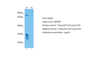 ZBTB20 Rabbit Polyclonal Antibody