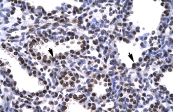 BARHL2 Rabbit Polyclonal Antibody