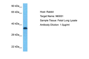 NKX6-1 Rabbit Polyclonal Antibody