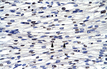 CGI-143 Rabbit Polyclonal Antibody