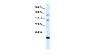 CGI-143 Rabbit Polyclonal Antibody
