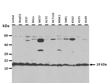 Zfp580 Rabbit Polyclonal Antibody