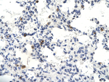SKIIP Rabbit Polyclonal Antibody