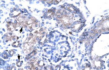 TBX19 Rabbit Polyclonal Antibody
