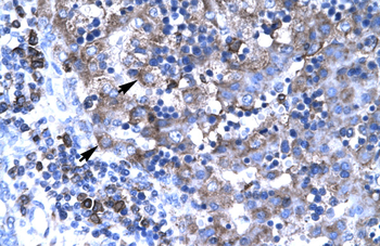 TBX19 Rabbit Polyclonal Antibody