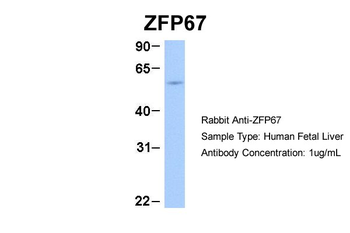 ZFP67 Rabbit Polyclonal Antibody