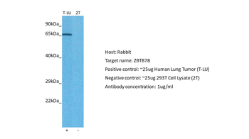 ZFP67 Rabbit Polyclonal Antibody
