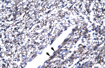 ZFP67 Rabbit Polyclonal Antibody