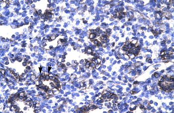 ZFP67 Rabbit Polyclonal Antibody
