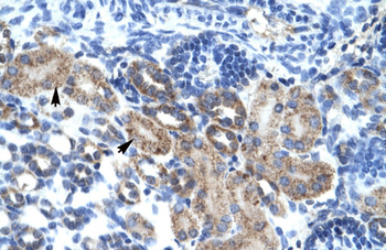 CGI-62 Rabbit Polyclonal Antibody