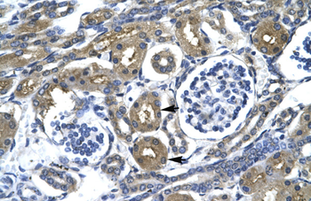 ZNFN1A1 Rabbit Polyclonal Antibody