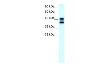 ACAT2 Rabbit Polyclonal Antibody