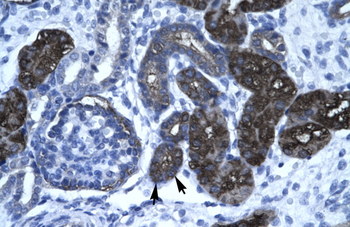 DKFZP761C169 Rabbit Polyclonal Antibody