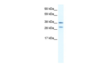 NKX2-3 Rabbit Polyclonal Antibody