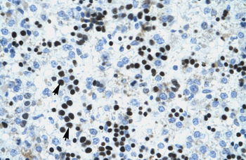 IVNS1ABP Rabbit Polyclonal Antibody