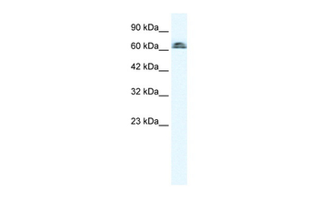 IVNS1ABP Rabbit Polyclonal Antibody