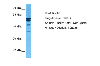 PRDM12 Rabbit Polyclonal Antibody