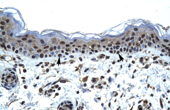 ZNFN1A5 Rabbit Polyclonal Antibody