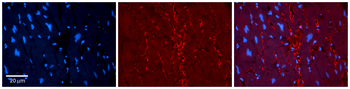 HTATIP Rabbit Polyclonal Antibody