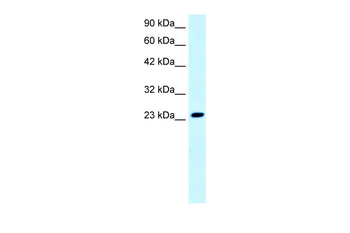 FLJ11730 Rabbit Polyclonal Antibody