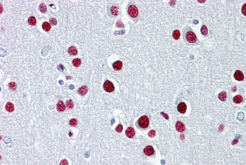 TUB Rabbit Polyclonal Antibody