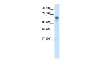 FLJ13798 Rabbit Polyclonal Antibody