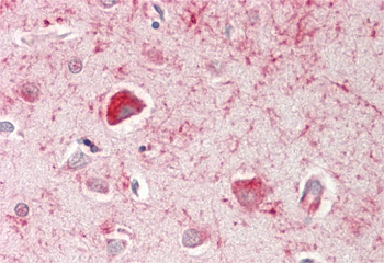 PLP1 Rabbit Polyclonal Antibody