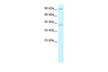 KIFC2 Rabbit Polyclonal Antibody