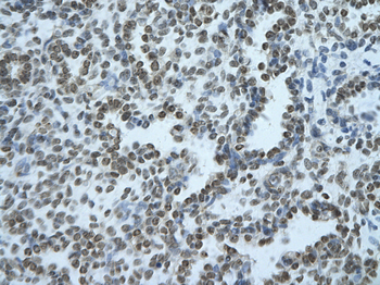 BHLHB2 Rabbit Polyclonal Antibody