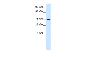 TCFL1 Rabbit Polyclonal Antibody