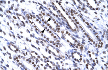 G22P1 Rabbit Polyclonal Antibody