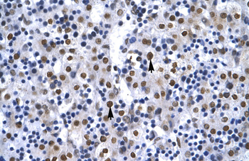 G22P1 Rabbit Polyclonal Antibody