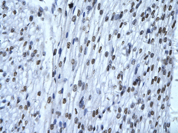 G22P1 Rabbit Polyclonal Antibody