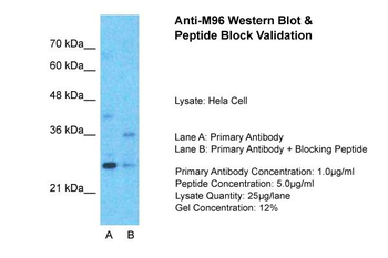 M96 Rabbit Polyclonal Antibody
