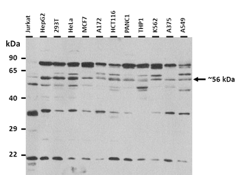 MGC4618 Rabbit Polyclonal Antibody