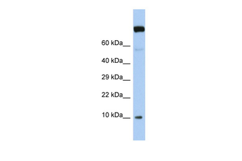 TCEAL9 Rabbit Polyclonal Antibody