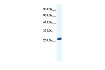 RTRAF Rabbit Polyclonal Antibody