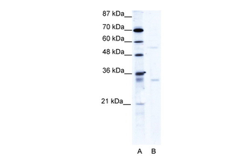 TRIM17 Rabbit Polyclonal Antibody