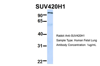 KMT5B Rabbit Polyclonal Antibody