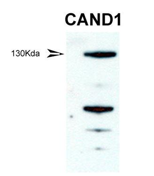 CAND1 Rabbit Polyclonal Antibody