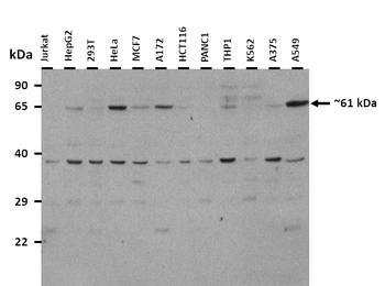 TRIM8 Rabbit Polyclonal Antibody