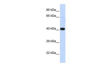 HSF2BP Rabbit Polyclonal Antibody