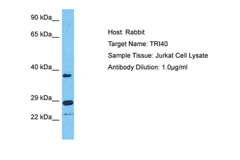 TRIM40 Rabbit Polyclonal Antibody